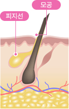 피지선,모공